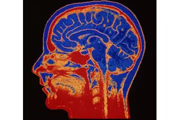 Nörobilim Özellikleri ve Faydaları Nelerdir?